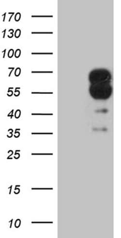 Invitrogen CRMP2 Monoclonal Antibody (OTI5D7) 100 &mu;L; Unconjugated:Antibodies,