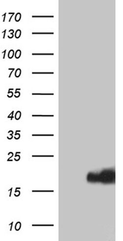 Invitrogen IFITM2 Monoclonal Antibody (OTI3B1) 100 &mu;L | Buy Online | Invitrogen&trade; | Fisher Scientific