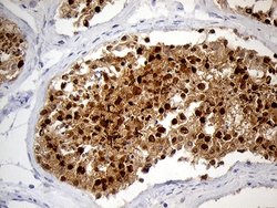 Invitrogen RACGAP1 Monoclonal Antibody (OTI3A5) 100 μL; Unconjugated:Antibodies,