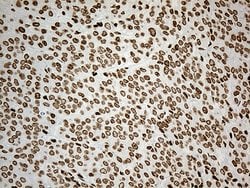 Invitrogen IRF2BP1 Monoclonal Antibody (OTI3A6) 100 &mu;L; Unconjugated:Antibodies,