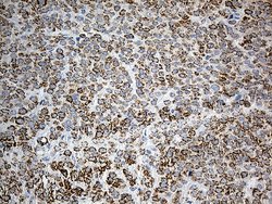 Invitrogen PYCR1 Monoclonal Antibody (OTI4F2) 100 &mu;L | Buy Online | Invitrogen&trade; | Fisher Scientific