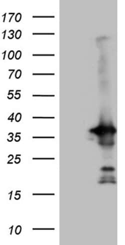 Invitrogen PYCR1 Monoclonal Antibody (OTI4F2) 100 &mu;L | Buy Online | Invitrogen&trade; | Fisher Scientific