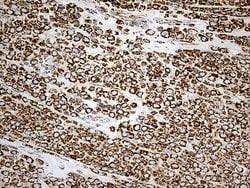 Invitrogen ACADM Monoclonal Antibody (OTI2G7) 100 &mu;L; Unconjugated:Antibodies,