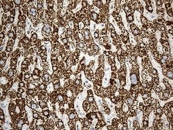 Invitrogen ACADM Monoclonal Antibody (OTI2G7) 100 &mu;L; Unconjugated:Antibodies,