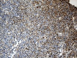 Invitrogen ACADM Monoclonal Antibody (OTI2G7) 100 &mu;L; Unconjugated:Antibodies,