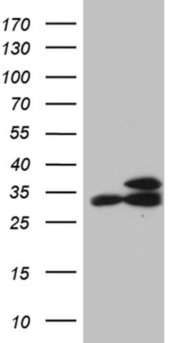 Invitrogen RPL7A Monoclonal Antibody (OTI4D5) 100 &mu;L | Buy Online | Invitrogen&trade; | Fisher Scientific