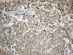 Invitrogen ACAD9 Monoclonal Antibody (OTI1D4) 100 &mu;L; Unconjugated:Antibodies,