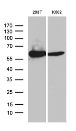 Invitrogen ACAD9 Monoclonal Antibody (OTI1D4) 100 &mu;L; Unconjugated:Antibodies,