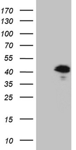 Invitrogen MGARP Monoclonal Antibody (OTI5B6) 100 &mu;L; Unconjugated:Antibodies,