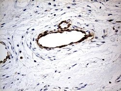 Invitrogen KIF6 Monoclonal Antibody (OTI5G2) 100 &mu;L; Unconjugated:Antibodies,