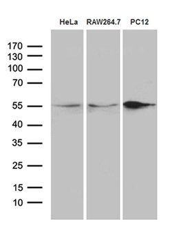Invitrogen SNX4 Monoclonal Antibody (OTI1B1) 100 &mu;L; Unconjugated:Antibodies,