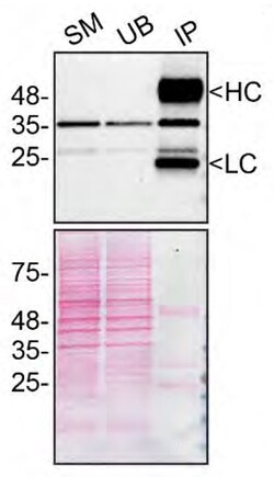 Invitrogen SCD Monoclonal Antibody (CD.E10) 100 &mu;g; Unconjugated:Antibodies,