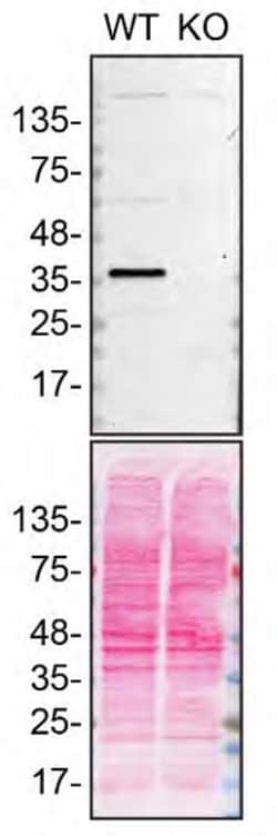 Invitrogen SCD Monoclonal Antibody (CD.E10) 100 &mu;g; Unconjugated:Antibodies,