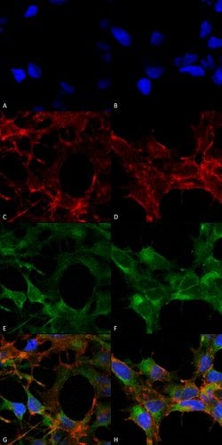 Invitrogen Acrolein Monoclonal Antibody (10A10) 100 &mu;g; Unconjugated:Antibodies,