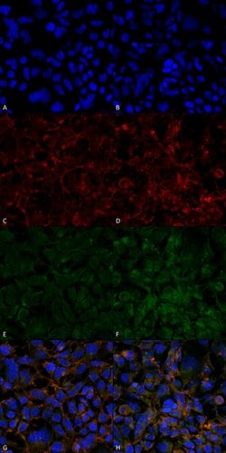 Invitrogen Hexanoyl-Lysine adduct Monoclonal Antibody (5E8) 100 &mu;g;