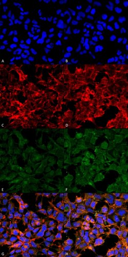 Invitrogen&trade;&nbsp;Malondialdehyde Monoclonal Antibody (11E3)