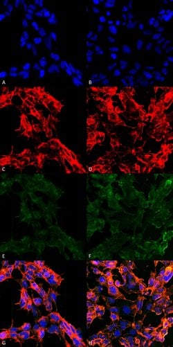 Invitrogen 7-Ketocholesterol Monoclonal Antibody (3F7) 100 &mu;g; Unconjugated:Antibodies,