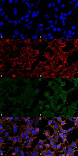 Invitrogen 4-Hydroxynonenal Monoclonal Antibody (12F7) 100 &mu;g; Unconjugated:Antibodies,