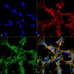 Invitrogen Citrulline Monoclonal Antibody (2D3.1) 100 &mu;g; Unconjugated:Antibodies,