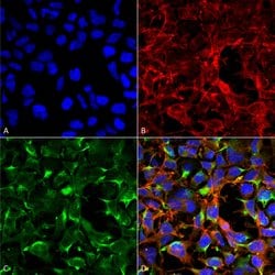 Invitrogen Dityrosine Monoclonal Antibody (7D4) 100 &mu;g; Unconjugated:Antibodies,