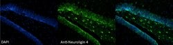 Invitrogen NLGN4X Monoclonal Antibody (N98/7) 100 &mu;g; Unconjugated:Antibodies,