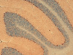 Invitrogen HCN1 Monoclonal Antibody (S70) 100 &mu;g; Unconjugated:Antibodies,