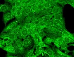 KCNT2 Monoclonal Antibody (S11-33), Invitrogen 100 &mu;g; Unconjugated:Antibodies,
