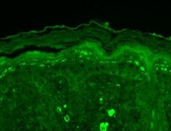 Invitrogen SHANK3 Monoclonal Antibody (S69) 100 &mu;g; Unconjugated:Antibodies,
