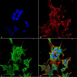 TRAK2 Monoclonal Antibody (S390-43), Invitrogen 100 &mu;g; Unconjugated:Antibodies,