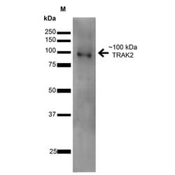 TRAK2 Monoclonal Antibody (S390-43), Invitrogen 100 &mu;g; Unconjugated:Antibodies,