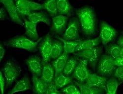 Invitrogen KCNT1 Monoclonal Antibody (N3/26) 100 &mu;g; Unconjugated:Antibodies,