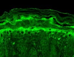 Invitrogen KCNT1 Monoclonal Antibody (N3/26) 100 &mu;g; Unconjugated:Antibodies,
