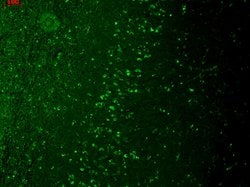 Invitrogen TRPM7 Monoclonal Antibody (S74) 100 &mu;g; Unconjugated:Antibodies,