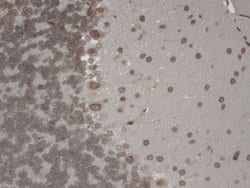 Invitrogen TRPM7 Monoclonal Antibody (S74) 100 &mu;g; Unconjugated:Antibodies,