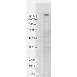 Invitrogen TRPM7 Monoclonal Antibody (S74) 100 &mu;g; Unconjugated:Antibodies,