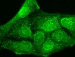 Invitrogen KCNMB3 Monoclonal Antibody (S40B-18) 100 &mu;g; Unconjugated:Antibodies,