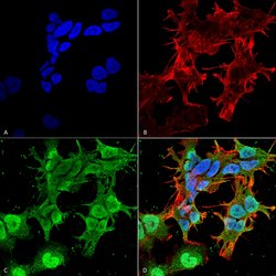 Invitrogen Stargazin Monoclonal Antibody (N245/36) 100 &mu;g; Unconjugated:Antibodies,