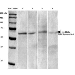 Invitrogen Stargazin Monoclonal Antibody (N245/36) 100 &mu;g; Unconjugated:Antibodies,