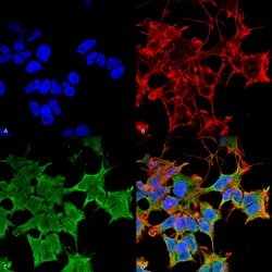 Invitrogen LGI1 Monoclonal Antibody (N283/7) 100 &mu;g; Unconjugated:Antibodies,