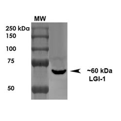 Invitrogen LGI1 Monoclonal Antibody (N283/7) 100 &mu;g; Unconjugated:Antibodies,