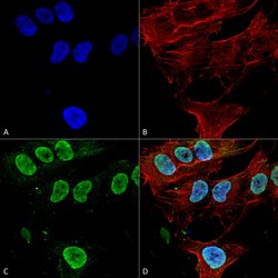 Invitrogen CaV3.1 Monoclonal Antibody (N178A/9) 100 &mu;g; Unconjugated:Antibodies,