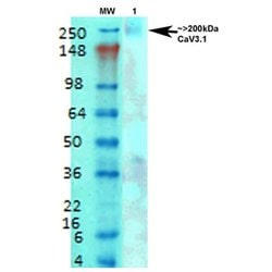 Invitrogen CaV3.1 Monoclonal Antibody (N178A/9) 100 &mu;g; Unconjugated:Antibodies,