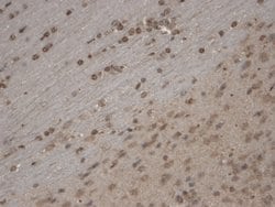 Invitrogen TRPC5 Monoclonal Antibody (N67/15) 100 &mu;g; Unconjugated:Antibodies,