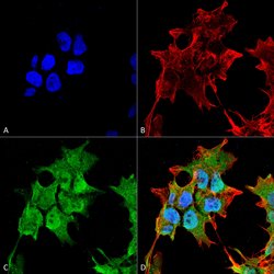 Invitrogen SUR1 Monoclonal Antibody (N289/16) 100 &mu;g; Unconjugated:Antibodies,