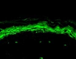 Invitrogen SCN10A Monoclonal Antibody (S134) 100 &mu;g; Unconjugated:Antibodies,