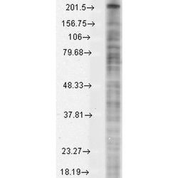 Invitrogen SCN10A Monoclonal Antibody (S134) 100 &mu;g; Unconjugated:Antibodies,