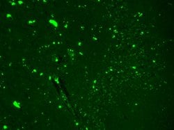 Invitrogen SCN9A Monoclonal Antibody (N68/6) 100 &mu;g; Unconjugated:Antibodies,