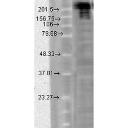 Invitrogen SCN9A Monoclonal Antibody (N68/6) 100 &mu;g; Unconjugated:Antibodies,