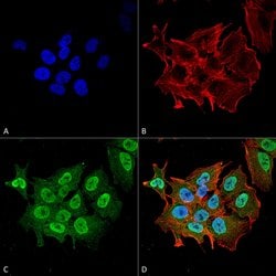 Invitrogen Ataxin 1 Monoclonal Antibody (N76/8) 100 &mu;g; Unconjugated:Antibodies,