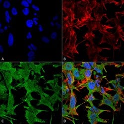 Invitrogen NRCAM Monoclonal Antibody (N364/51) 100 &mu;g; Unconjugated:Antibodies,